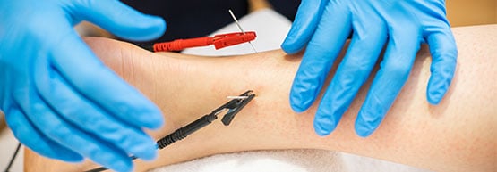 Patient receiving a dry needling treatment.